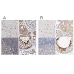 SPATA20 Antibody in Immunohistochemistry (IHC)