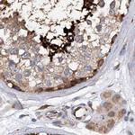 SPATA20 Antibody in Immunohistochemistry (IHC)