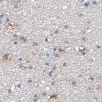 SPATA20 Antibody in Immunohistochemistry (IHC)