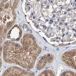 SPATA20 Antibody in Immunohistochemistry (IHC)