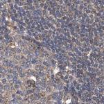 SPATA20 Antibody in Immunohistochemistry (IHC)