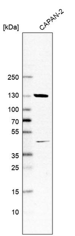 EXOC4 Antibody in Western Blot (WB)