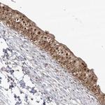 C1orf58 Antibody in Immunohistochemistry (Paraffin) (IHC (P))
