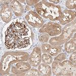 GLMN Polyclonal Antibody