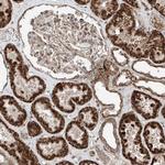 ZNF620 Antibody in Immunohistochemistry (Paraffin) (IHC (P))