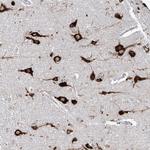 FAM83B Polyclonal Antibody