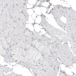HRNR Antibody in Immunohistochemistry (Paraffin) (IHC (P))