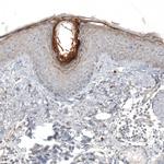 HRNR Antibody in Immunohistochemistry (Paraffin) (IHC (P))