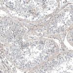 HRNR Antibody in Immunohistochemistry (Paraffin) (IHC (P))