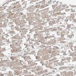 CAZIP Antibody in Immunohistochemistry (IHC)
