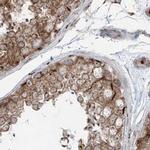XTP3B Antibody in Immunohistochemistry (IHC)