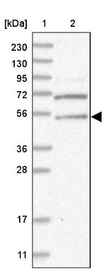 XTP3B Antibody in Western Blot (WB)