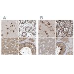 XTP3B Polyclonal Antibody