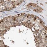 XTP3B Antibody in Immunohistochemistry (IHC)