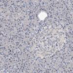 STK19 Antibody in Immunohistochemistry (Paraffin) (IHC (P))
