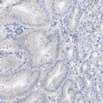 STK19 Antibody in Immunohistochemistry (Paraffin) (IHC (P))