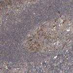 STK19 Polyclonal Antibody