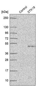 STK19 Antibody in Western Blot (WB)
