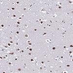 POLR1A Antibody in Immunohistochemistry (Paraffin) (IHC (P))