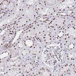 POLR1A Antibody in Immunohistochemistry (Paraffin) (IHC (P))