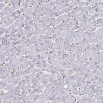 POLR1A Antibody in Immunohistochemistry (Paraffin) (IHC (P))