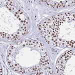 POLR1A Antibody in Immunohistochemistry (Paraffin) (IHC (P))