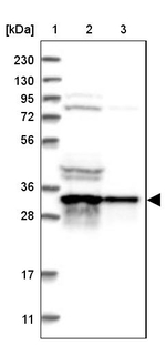 V-ATPase D Antibody in Western Blot (WB)