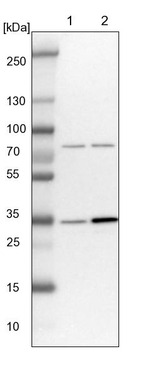 V-ATPase D Antibody in Western Blot (WB)