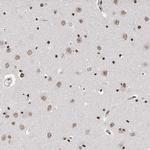 RP9 Antibody in Immunohistochemistry (IHC)