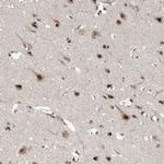 RPAIN Antibody in Immunohistochemistry (Paraffin) (IHC (P))