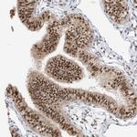 RPAIN Antibody in Immunohistochemistry (Paraffin) (IHC (P))