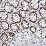 RPAIN Antibody in Immunohistochemistry (Paraffin) (IHC (P))