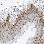 RPAIN Antibody in Immunohistochemistry (Paraffin) (IHC (P))