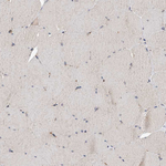 GMDS Antibody in Immunohistochemistry (Paraffin) (IHC (P))