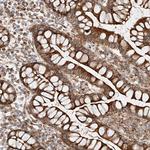 CSGALNACT2 Antibody in Immunohistochemistry (Paraffin) (IHC (P))