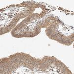 CXorf58 Antibody in Immunohistochemistry (Paraffin) (IHC (P))