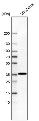 MTX2 Antibody in Western Blot (WB)