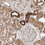 MTX2 Polyclonal Antibody