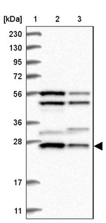 MTX2 Antibody in Western Blot (WB)