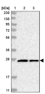 MTX2 Antibody in Western Blot (WB)