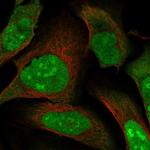 MAGED2 Polyclonal Antibody