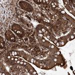 MAGED2 Antibody in Immunohistochemistry (Paraffin) (IHC (P))