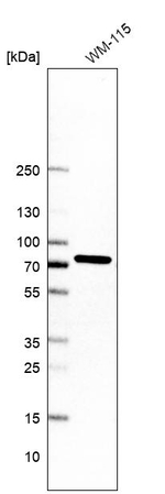 MAGED2 Antibody in Western Blot (WB)