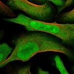 MAGED2 Polyclonal Antibody