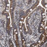 BCKDHB Antibody in Immunohistochemistry (Paraffin) (IHC (P))