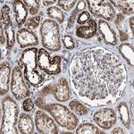 BCKDHB Antibody in Immunohistochemistry (Paraffin) (IHC (P))