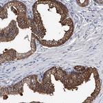BCKDHB Antibody in Immunohistochemistry (Paraffin) (IHC (P))