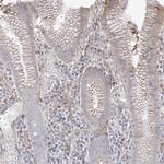 DCDC2 Antibody in Immunohistochemistry (Paraffin) (IHC (P))