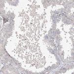 DCDC2 Antibody in Immunohistochemistry (IHC)