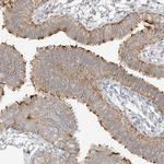 DCDC2 Antibody in Immunohistochemistry (IHC)